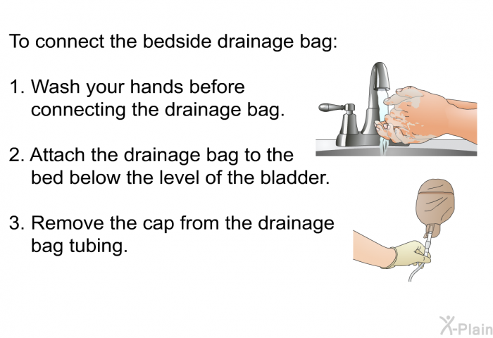 To connect the bedside drainage bag:  Wash your hands before connecting the drainage bag. Attach the drainage bag to the bed below the level of the bladder. Remove the cap from the drainage bag tubing.