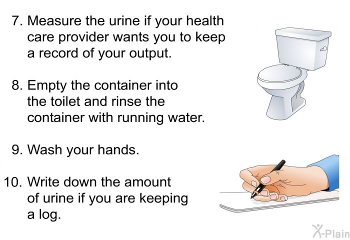 Measure the urine if your health care provider wants you to keep a record of your output. Empty the container into the toilet and rinse the container with running water. Wash your hands. Write down the amount of urine if you are keeping a log.