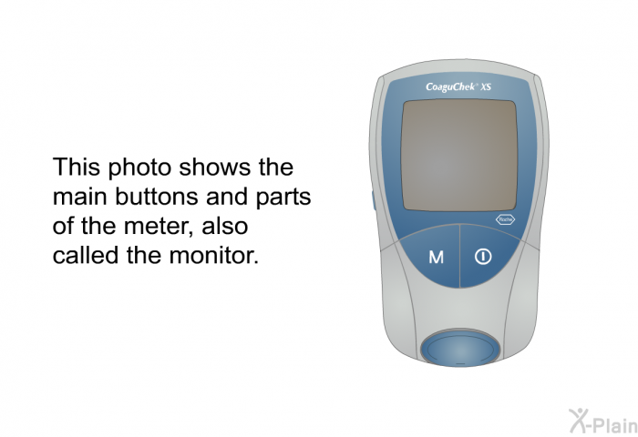 This photo shows the main buttons and parts of the meter, also called the monitor.