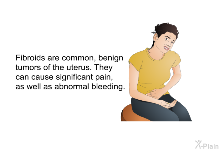 Fibroids are common, benign tumors of the uterus. They can cause significant pain, as well as abnormal bleeding.