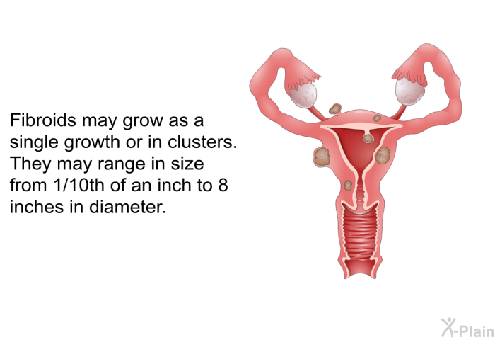 Fibroids may grow as a single growth or in clusters. They may range in size from 1/10th of an inch to 8 inches in diameter.