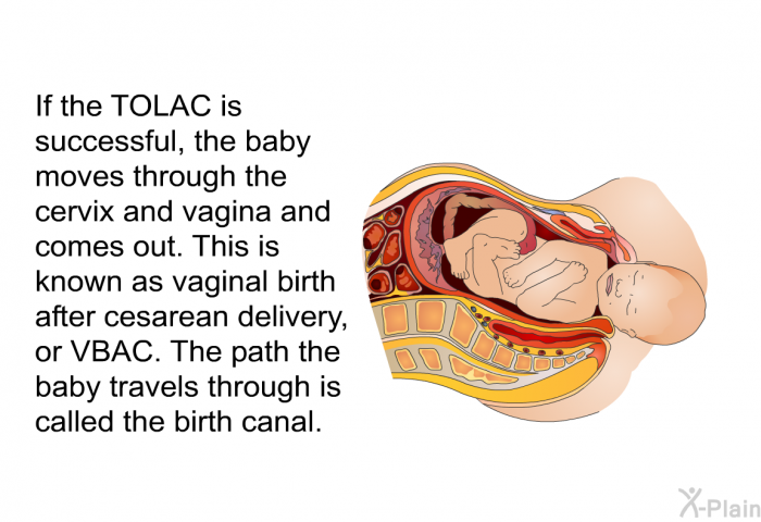 If the TOLAC is successful, the baby moves through the cervix and vagina and comes out. This is known as vaginal birth after cesarean delivery, or VBAC. The path the baby travels through is called the birth canal.