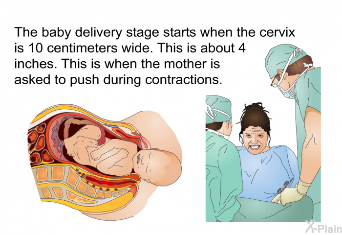 The baby delivery stage starts when the cervix is 10 centimeters wide. This is about 4 inches. This is when the mother is asked to push during contractions.