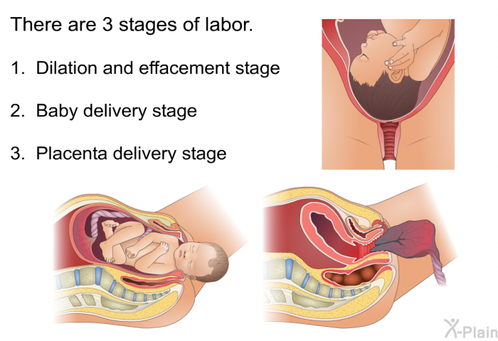 There are 3 stages of labor.  Dilation and effacement stage Baby delivery stage Placenta delivery stage