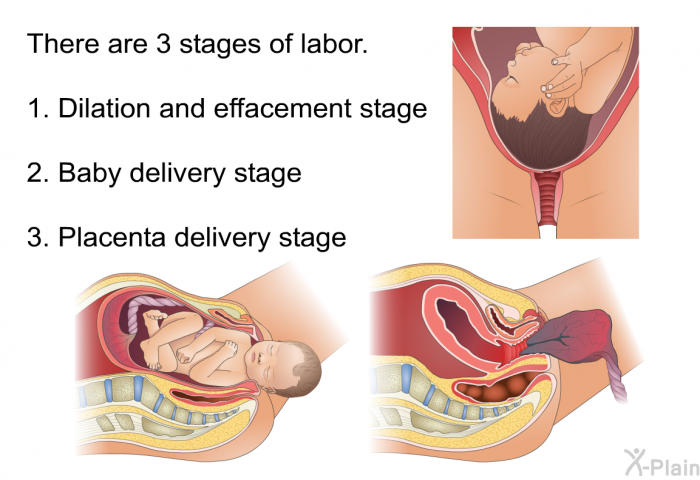 There are 3 stages of labor.  Dilation and effacement stage Baby delivery stage Placenta delivery stage