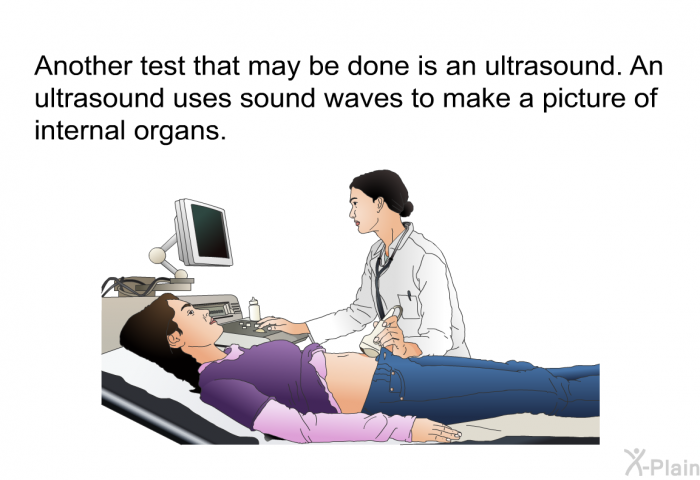 Another test that may be done is an ultrasound. An ultrasound uses sound waves to make a picture of internal organs.