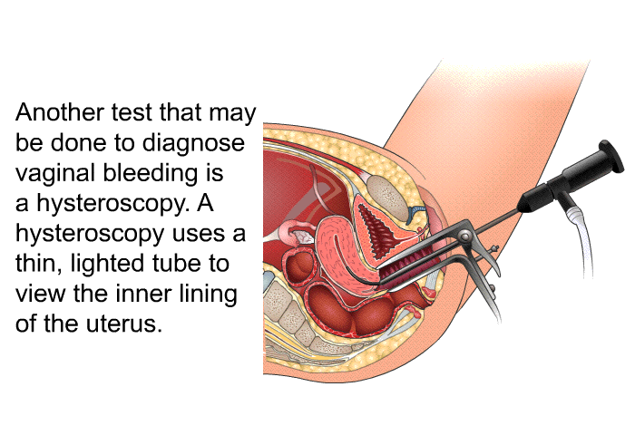 Another test that may be done to diagnose vaginal bleeding is a hysteroscopy. A hysteroscopy uses a thin, lighted tube to view the inner lining of the uterus.