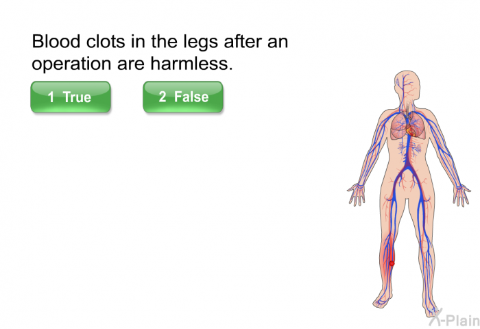 Blood clots in the legs after an operation are harmless.