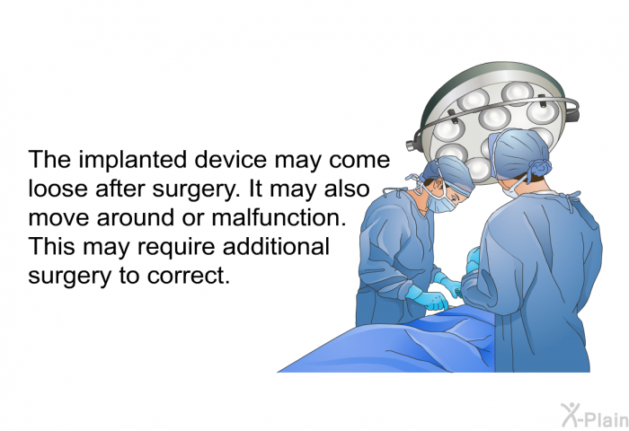 The implanted device may come loose after surgery. It may also move around or malfunction. This may require additional surgery to correct.