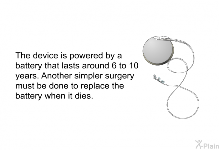 The device is powered by a battery that lasts around 6 to 10 years. Another simpler surgery must be done to replace the battery when it dies.