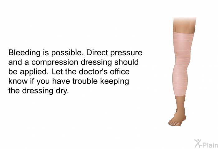 Bleeding is possible. Direct pressure and a compression dressing should be applied. Let the doctor's office know if you have trouble keeping the dressing dry.