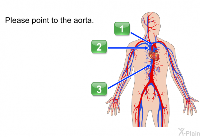 Please point to the aorta.