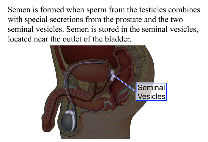 Semen is formed when sperm from the testicles combines with special secretions from the prostate and the two seminal vesicles. Semen is stored in the seminal vesicles, located near the outlet of the bladder.