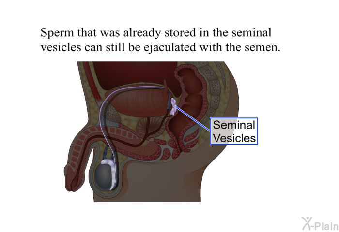 Sperm that was already stored in the seminal vesicles can still be ejaculated with the semen.