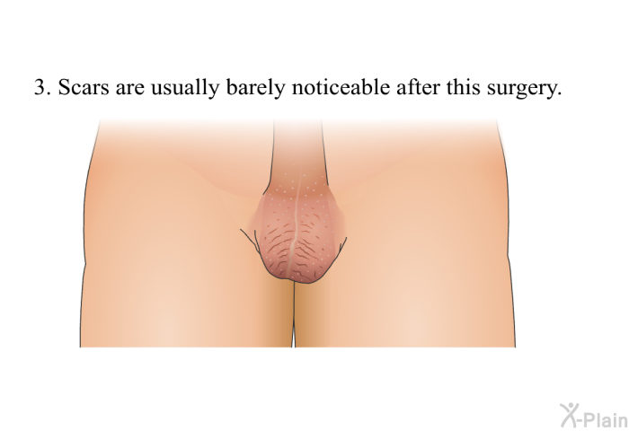Scars are usually barely noticeable after this surgery.