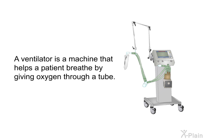 A ventilator is a machine that helps a patient breathe by giving oxygen through a tube.