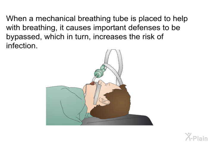 When a mechanical breathing tube is placed to help with breathing, it causes important defenses to be bypassed, which in turn, increases the risk of infection.