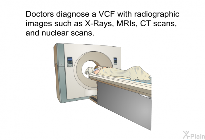 Doctors diagnose a VCF with radiographic images such as X-Rays, MRIs, CT scans, and nuclear scans.