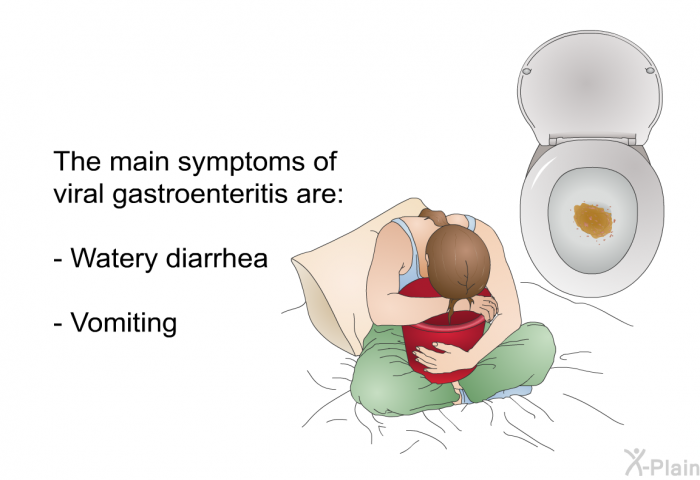 The main symptoms of viral gastroenteritis are:  Watery diarrhea Vomiting