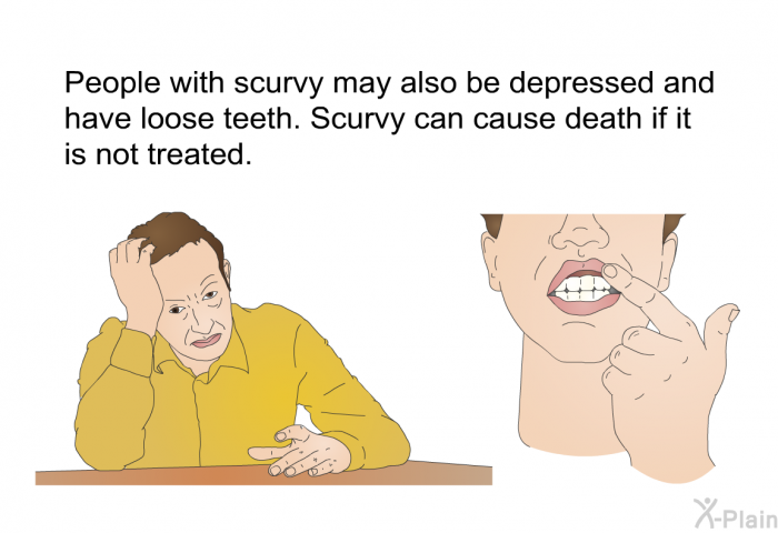 People with scurvy may also be depressed and have loose teeth. Scurvy can cause death if it is not treated.