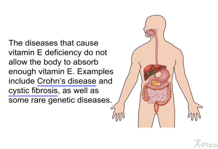 The diseases that cause vitamin E deficiency do not allow the body to absorb enough vitamin E. Examples include Crohn’s disease and cystic fibrosis, as well as some rare genetic diseases.