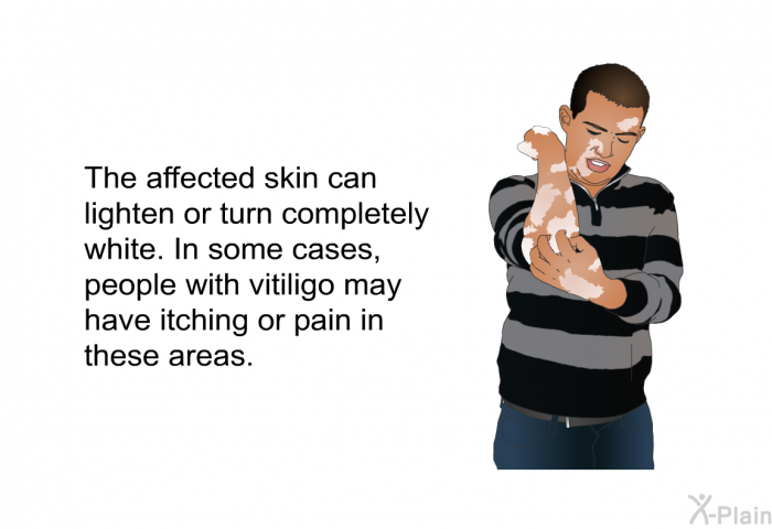 The affected skin can lighten or turn completely white. In some cases, people with vitiligo may have itching or pain in these areas.