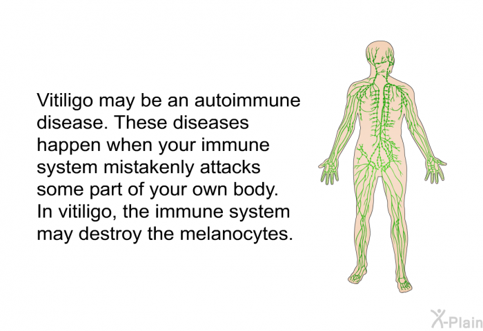Vitiligo may be an autoimmune disease. These diseases happen when your immune system mistakenly attacks some part of your own body. In vitiligo, the immune system may destroy the melanocytes.