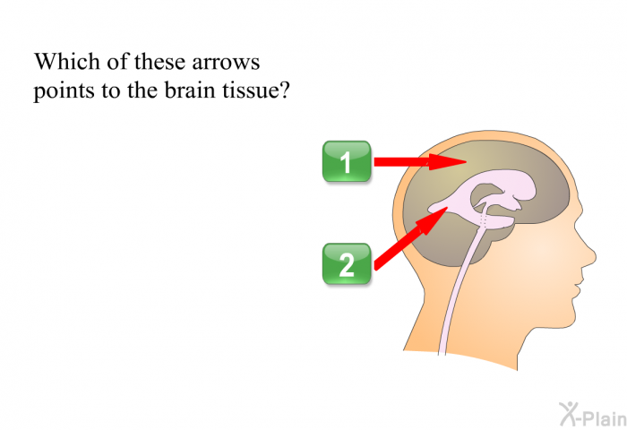 Which of these arrows points to the brain tissue?