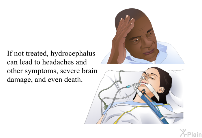If not treated, hydrocephalus can lead to headaches and other symptoms, severe brain damage, and even death.