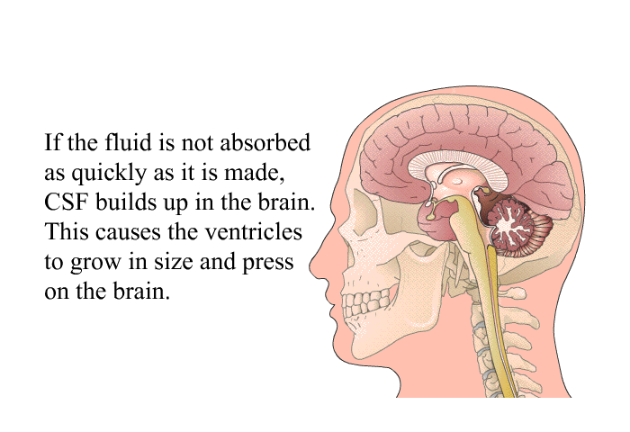 If the fluid is not absorbed as quickly as it is made, CSF builds up in the brain. This causes the ventricles to grow in size and press on the brain.