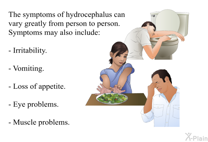 The symptoms of hydrocephalus can vary greatly from person to person. Symptoms may also include:  Irritability. Vomiting. Loss of appetite. Eye problems. Muscle problems.