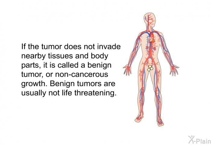 If the tumor does not invade nearby tissues and body parts, it is called a benign tumor, or non-cancerous growth. Benign tumors are usually not life threatening.
