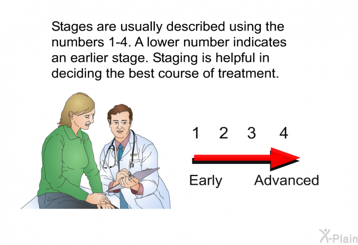 Stages are usually described using the numbers 1-4. A lower number indicates an earlier stage. Staging is helpful in deciding the best course of treatment.