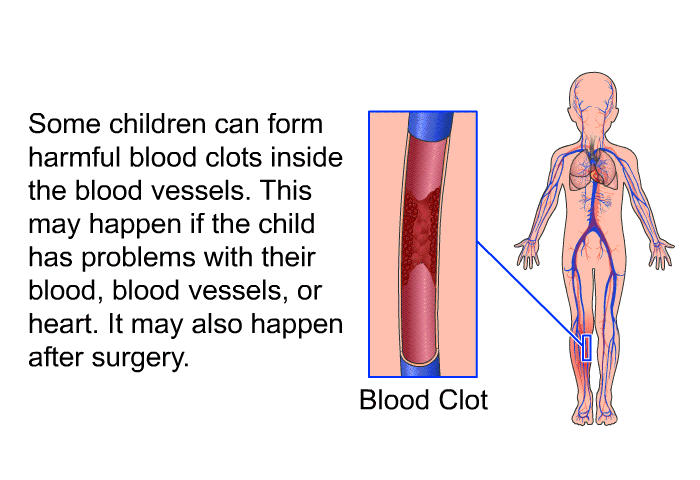 Some children can form harmful blood clots inside the blood vessels. This may happen if the child has problems with their blood, blood vessels, or heart. It may also happen after surgery.