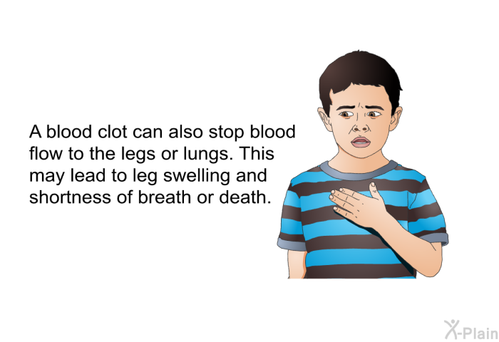A blood clot can also stop blood flow to the legs or lungs. This may lead to leg swelling and shortness of breath or death.