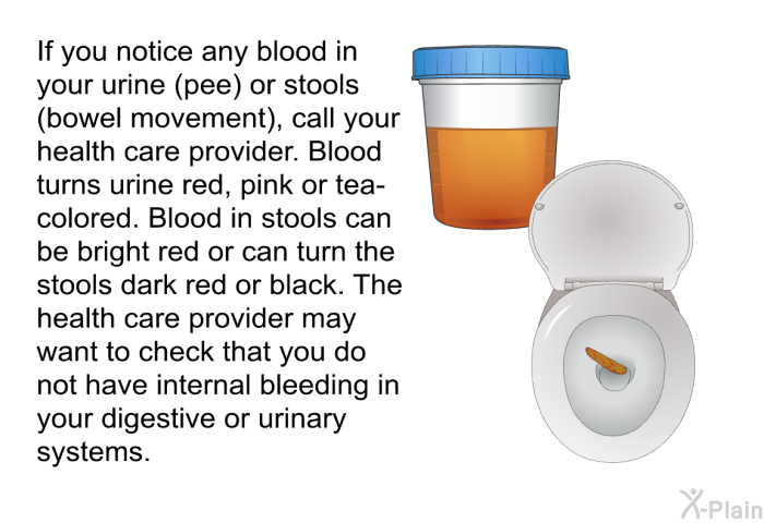 If you notice any blood in your urine (pee) or stools (bowel movement), call your health care provider. Blood turns urine red, pink or tea-colored. Blood in stools can be bright red or can turn the stools dark red or black. The health care provider may want to check that you do not have internal bleeding in your digestive or urinary systems.