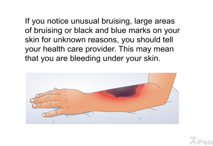 If you notice unusual bruising, large areas of bruising or black and blue marks on your skin for unknown reasons, you should tell your health care provider. This may mean that you are bleeding under your skin.