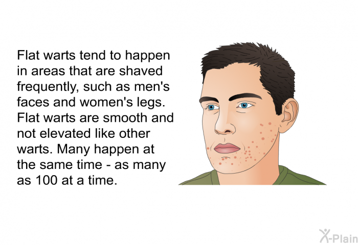 Flat warts tend to happen in areas that are shaved frequently, such as men's faces and women's legs. Flat warts are smooth and not elevated like other warts. Many happen at the same time - as many as 100 at a time.