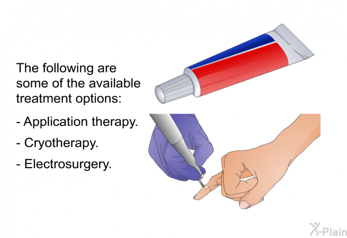 The following are some of the available treatment options:  Application therapy. Cryotherapy. Electrosurgery.