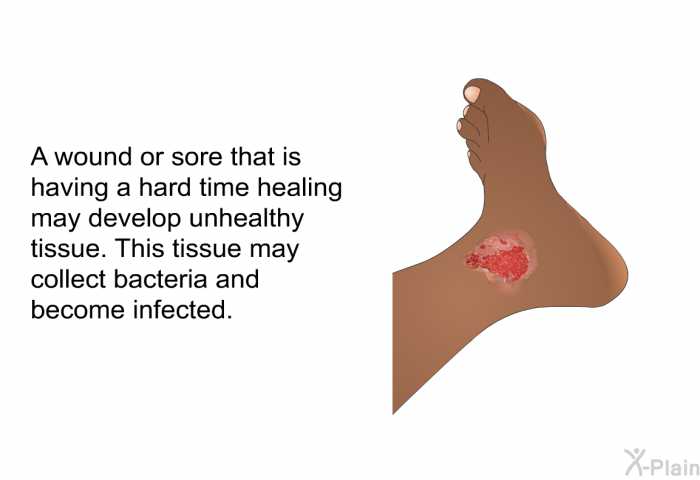 A wound or sore that is having a hard time healing may develop unhealthy tissue. This tissue may collect bacteria and become infected.