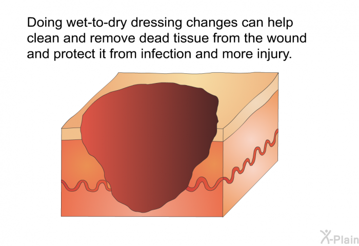 Doing wet-to-dry dressing changes can help clean and remove dead tissue from the wound and protect it from infection and more injury.