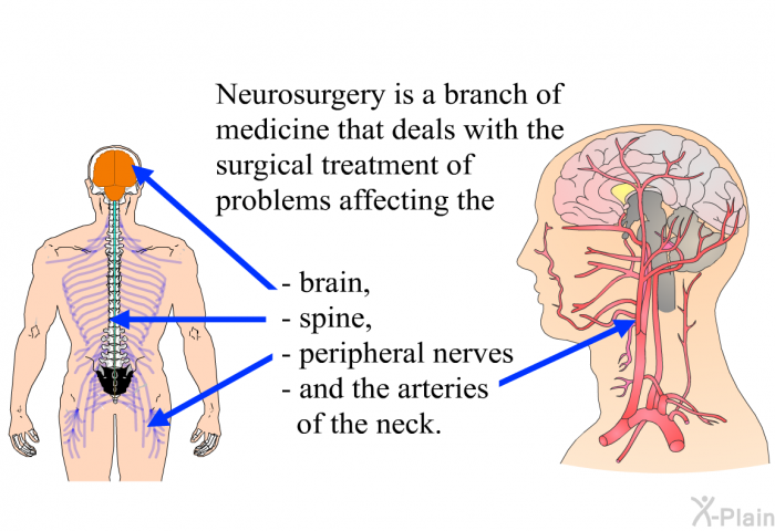 Neurosurgery is a branch of medicine that deals with the surgical treatment of problems affecting the  brain, spine, peripheral nerves and the arteries of the neck.