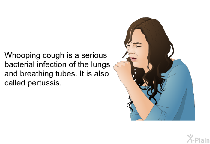 Whooping cough is a serious bacterial infection of the lungs and breathing tubes. It is also called pertussis.