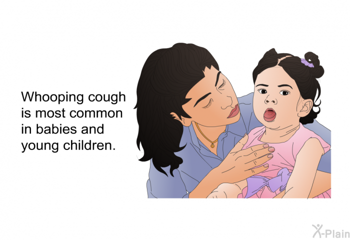 Whooping cough is most common in babies and young children.