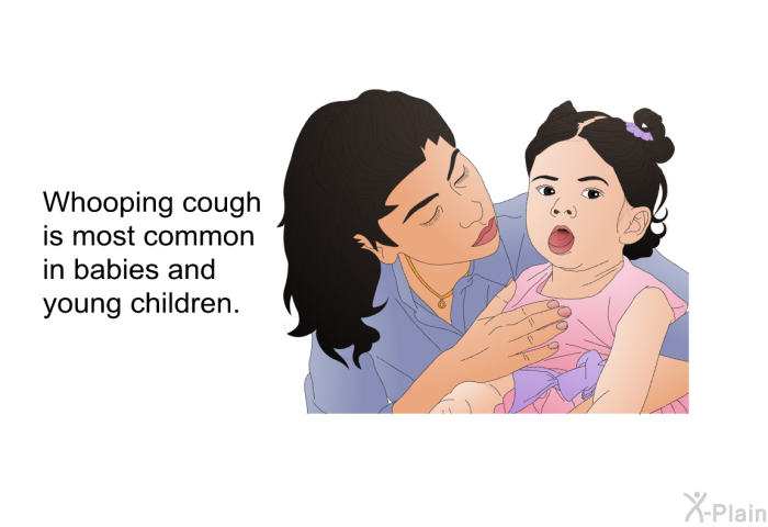 Whooping cough is most common in babies and young children.