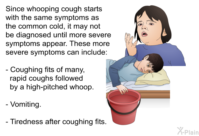 Since whooping cough starts with the same symptoms as the common cold, it may not be diagnosed until more severe symptoms appear. These more severe symptoms can include:  Coughing fits of many, rapid coughs followed by a high-pitched whoop. Vomiting. Tiredness after coughing fits.