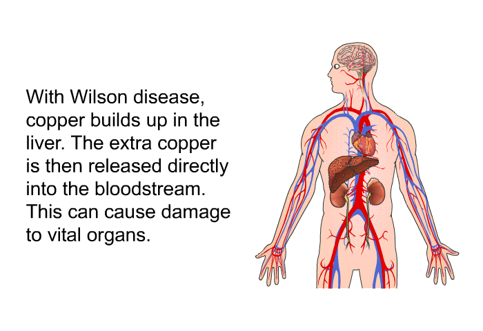 With Wilson disease, copper builds up in the liver. The extra copper is then released directly into the bloodstream. This can cause damage to vital organs.