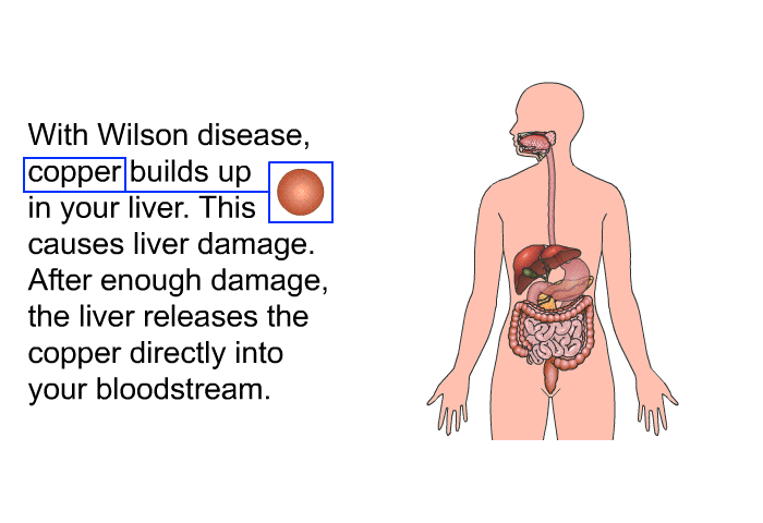 With Wilson disease, copper builds up in your liver. This causes liver damage. After enough damage, the liver releases the copper directly into your bloodstream.