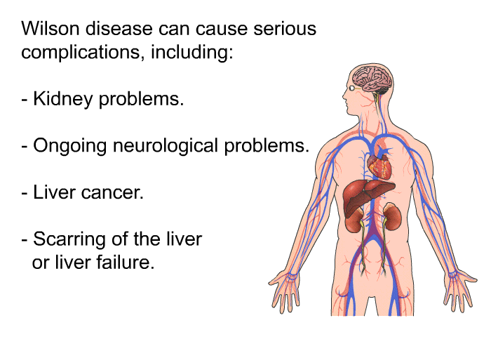 Wilson disease can cause serious complications, including:  Kidney problems. Ongoing neurological problems. Liver cancer. Scarring of the liver or liver failure.