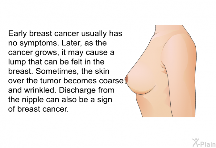 Early breast cancer usually has no symptoms. Later, as the cancer grows, it may cause a lump that can be felt in the breast. Sometimes, the skin over the tumor becomes coarse and wrinkled. Discharge from the nipple can also be a sign of breast cancer.